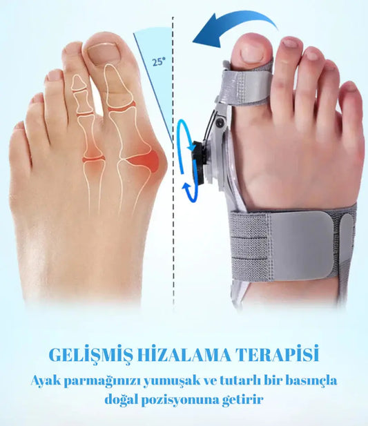 Halluks Valgus Düzeltme Aparatı MNDStore