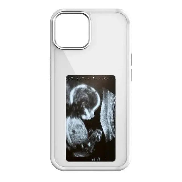 Dijital Telefon Kılıfı - MNDStore